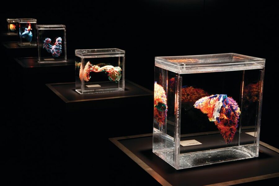Las Vegas: BODIES | The Exhibition at the Luxor - What you actually see at Luxor
